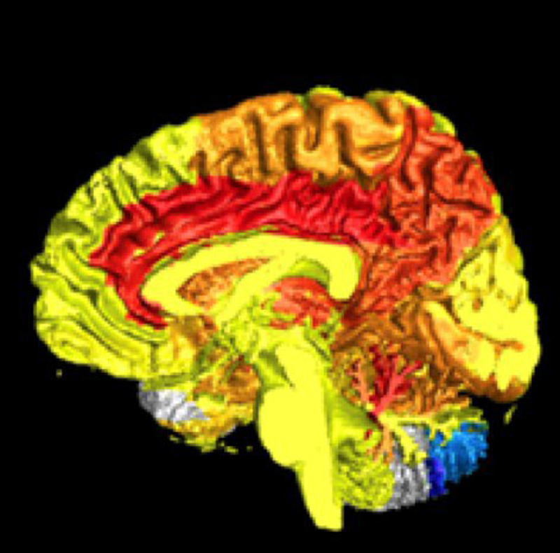 El cerebro de las mujeres es más activo que el de los hombres